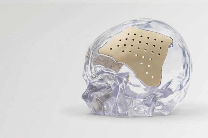 机器人减肥？特斯拉Optimus炒热的新细分赛道，市场需求将达167亿以上(图1)