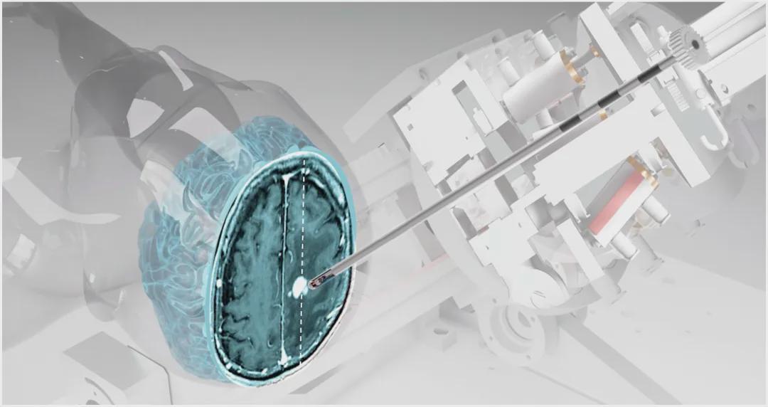 国家专项新突破！中国团队自主研发核磁兼容手术机器人，实现亚毫米级精度！(图1)
